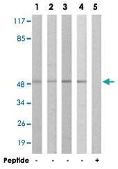 Anti-IL13RA1 Rabbit Polyclonal Antibody