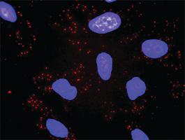 Anti-CACYBP + TBL1X Antibody Pair