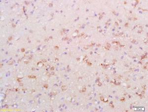 Anti-ULK1 Rabbit Polyclonal Antibody