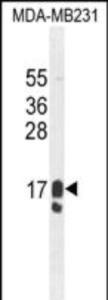 Anti-PIP Rabbit Polyclonal Antibody