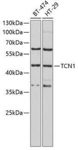 Anti-TCN1 antibody