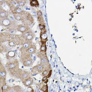 Immunohistochemistry analysis of paraffin-embedded human liver using Anti-Ceruloplasmin Antibody [ARC5018-06] (A306336) at a dilution of 1:100 (40x lens). Perform high pressure antigen retrieval with 10 mM citrate buffer pH 6.0 before commencing with IHC staining protocol.