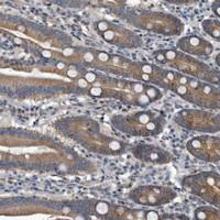 Anti-FAM136A Rabbit Polyclonal Antibody