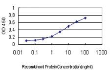 Anti-SSR4 Mouse Monoclonal Antibody [clone: 2D3]