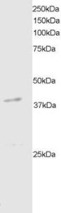 Antibody anti-DAP kinase 2 100 µg