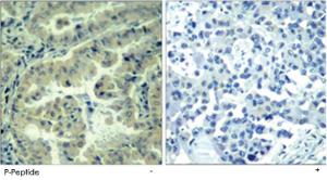 Anti-EIF4G1 Rabbit Polyclonal Antibody