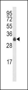 Anti-MYD88 Rabbit Polyclonal Antibody (AP (Alkaline Phosphatase))