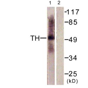 Western blot analysis of lysates from HepG2 cells using Anti-Tryptophan Hydroxylase Antibody. The right hand lane represents a negative control, where the antibody is blocked by the immunising peptide.