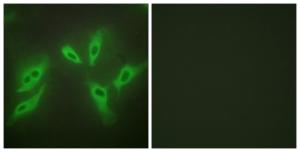 Anti-TUSC3 antibody