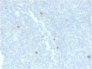 Immunohistochemical analysis of formalin-fixed, paraffin-embedded human tonsil using Anti-Human IgM Heavy Chain Antibody [rIM373]