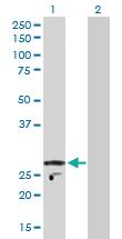 Anti-KCNIP2 Rabbit Polyclonal Antibody