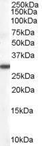 Anti-DDAH2 Antibody (A83805) (0.1µg/ml) staining of Human Lung lysate (35µg protein in RIPA buffer). Primary incubation was 1 hour. Detected by chemiluminescence.