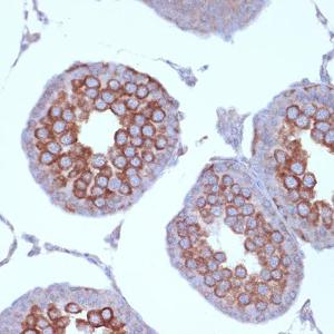 Immunohistochemistry analysis of paraffin-embedded rat testis using Anti-KIF3A Antibody [ARC1428] (A309246) at a dilution of 1:100 (40x lens) Perform microwave antigen retrieval with 10 mM Tris/EDTA buffer pH 90 before commencing with IHC staining protocol