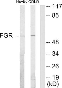 Western blot analysis of lysates from HUVEC and COLO205 cells using Anti-FGR Antibody. The right hand lane represents a negative control, where the antibody is blocked by the immunising peptide