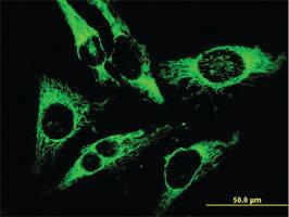 Anti-PRDX3 Mouse Monoclonal Antibody [clone: 1E3-B2]