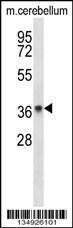 Anti-PAQR8 Rabbit Polyclonal Antibody (AP (Alkaline Phosphatase))