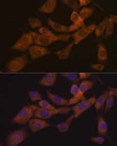 Immunofluorescence analysis of NIH-3T3 cells using Anti-KIF3A Antibody [ARC1428] (A309246) at a dilution of 1:100 (40x lens) DAPI was used to stain the cell nuclei (blue)