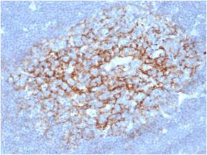 Immunohistochemical analysis of formalin-fixed, paraffin-embedded human lymph node using Anti-CD23 Antibody [FCER2/6892] at 2 µg/ml in PBS for 30  minutes at room temperature