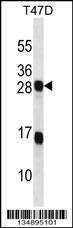 Anti-KDELR2 Rabbit Polyclonal Antibody