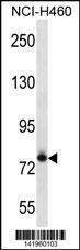 Anti-FCRL3 Rabbit Polyclonal Antibody