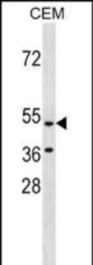 Anti-HCAR3 Rabbit Polyclonal Antibody (APC (Allophycocyanin))