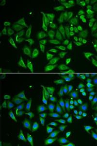 Immunofluorescence analysis of HeLa cells using Anti-Tetranectin Antibody (A9859) DAPI was used to stain the cell nuclei (blue)