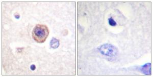 Immunohistochemical analysis of paraffin-embedded human brain tissue using Anti-Tryptophan Hydroxylase Antibody. The right hand panel represents a negative control, where the antibody was pre-incubated with the immunising peptide.