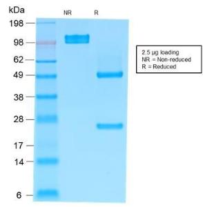 SDS-PAGE analysis of Anti-Human IgM Heavy Chain Antibody [rIM373] under non-reduced and reduced conditions; showing intact IgG and intact heavy and light chains, respectively. SDS-PAGE analysis confirms the integrity and purity of the Antibody