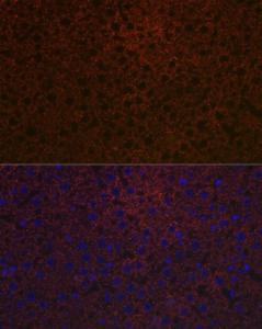 Immunofluorescence analysis of rat liver using Anti-Ceruloplasmin Antibody [ARC5018-06] (A306336) at a dilution of 1:100 (40x lens). DAPI was used to stain the cell nuclei (blue).