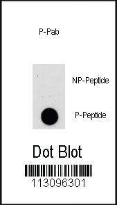 Anti-AKT1 Rabbit Polyclonal Antibody