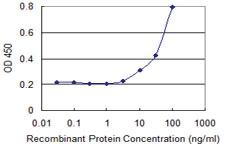 Anti-SSTR1 Mouse Monoclonal Antibody [clone: 4E3]