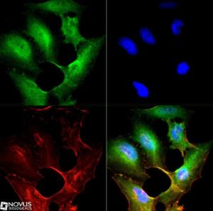 Anti-MYC Mouse Monoclonal Antibody [clone: 9E10]