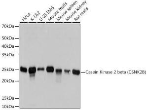 Western blot analysis of extracts of various cell lines, using Anti-Casein Kinase 2 beta Antibody [ARC1069] (A309247) at 1:1,000 dilution