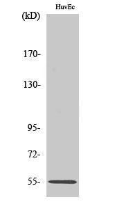 Western blot analysis of various cells using Anti-FGR Antibody