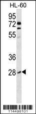 Anti-RHOB Rabbit Polyclonal Antibody