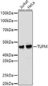 Western blot analysis of extracts of various cell lines, using Anti-TUFM Antibody (A9861) at 1:1,000 dilution. The secondary antibody was Goat Anti-Rabbit IgG H&L Antibody (HRP) at 1:10,000 dilution.