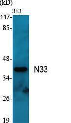 Anti-TUSC3 antibody