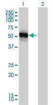 Anti-GPT Mouse Monoclonal Antibody [clone: 4E2]