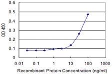 Anti-GPT Mouse Monoclonal Antibody [clone: 4E2]