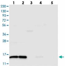 Anti-FAM136A Rabbit Polyclonal Antibody