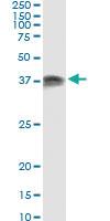 Anti-PRKRA Antibody Pair