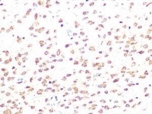 Immunohistochemistry analysis of paraffin-embedded rat brain using Anti-Casein Kinase 2 beta Antibody [ARC1069] (A309247) at a dilution of 1:100 (40X lens). Perform microwave antigen retrieval with 10 mM PBS buffer pH 7.2 before commencing with IHC staining protocol