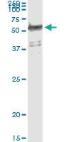 Anti-WARS Antibody Pair