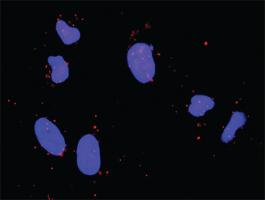 Anti-FGF5 + FGFR4 Antibody Pair