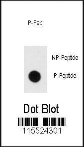 Anti-MBP Rabbit Polyclonal Antibody (AP (Alkaline Phosphatase))