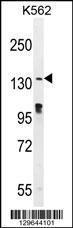 Anti-OVOS Rabbit Polyclonal Antibody (PE (Phycoerythrin))