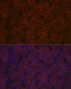 Immunofluorescence analysis of human liver using Anti-Ceruloplasmin Antibody [ARC5018-06] (A306336) at a dilution of 1:100 (40x lens). DAPI was used to stain the cell nuclei (blue).