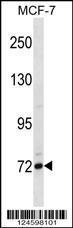 Anti-FCRL5 Rabbit Polyclonal Antibody (AP (Alkaline Phosphatase))