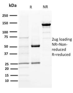 SDS-PAGE analysis of Anti-TMEM16A Antibody [DG1/1484] under non-reduced and reduced conditions; showing intact IgG and intact heavy and light chains, respectively. SDS-PAGE analysis confirms the integrity and purity of the antibody.