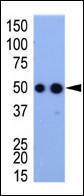 Anti-HA tag Rabbit Polyclonal Antibody (PE (Phycoerythrin))